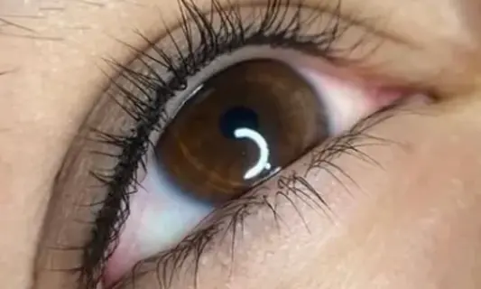 Microlash